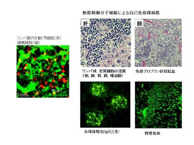 Disregulated of immune-cell trafficking signaling and development of autoimmunity