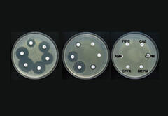 細菌の抗生物質感受性試験：菌が多剤耐性化するとほとんどの抗生物質が効かなくなる。