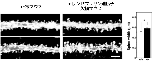 図６　成体における正常マウスおよびテレンセファリン遺伝子欠損マウスのスパイン形態