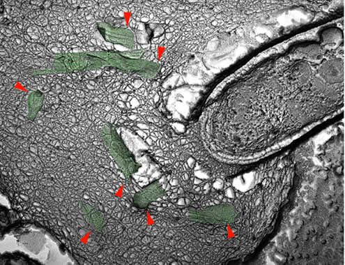 図２　赤痢菌によって破断された微小管の電子顕微鏡像