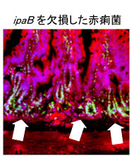 ipaBを欠損した赤痢菌