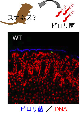 図2　ピロリ菌は胃表層の上皮細胞上に定着する
