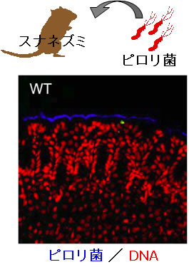 図2 ピロリ菌は胃表層の上皮細胞上に定着する