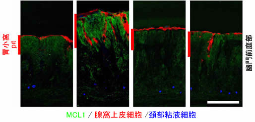 図4　ピロリ菌感染による胃上皮細胞MCL1発現上昇