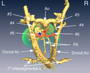 図3：第6鰓弓動脈の変化（受精後12.0 日目）