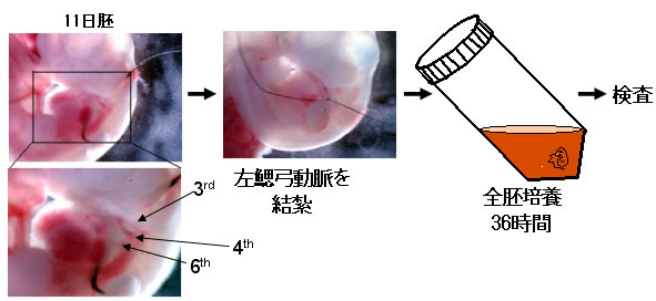図4：左側第6鰓弓動脈を結紮（消失するはずの右側第6鰓弓動脈が残る）