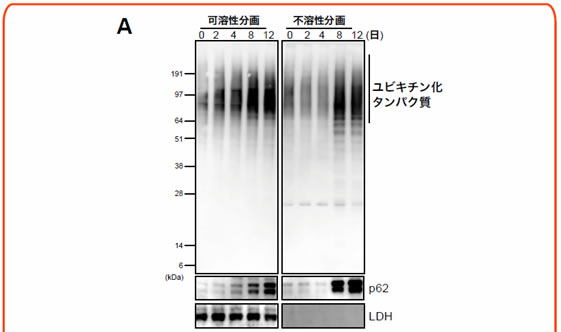 図２　オートファジー欠損に伴う細胞内ユビキチン－p62陽性封入体形成過程