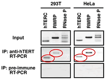 図２　テロメレース逆転写酵素（TERT）がRMRPと結合していることを示す実験結果