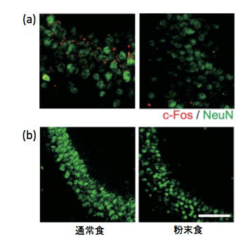 図３　海馬CA3領域における (a)神経活動 (b)神経細胞数の変化