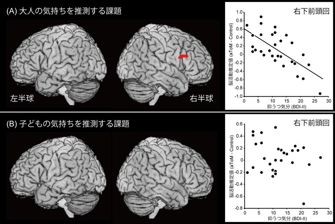 図２　大人または子どもの気持ちを推測する課題時に選択的な脳活動と抑うつ気分の間で関連を示した脳領域