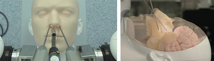 図１　経鼻内視鏡手術を想定したスマートアームの操作（バイオニックヒューマノイドを用いた 評価と透視イメージ）