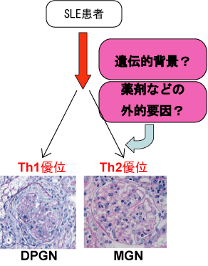 図４　ヒトSLEにおける、免疫反応バランスによるDPGNとMGNの病態決定