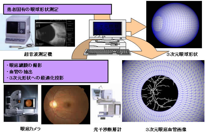（図１）三次元眼球画像構築システム