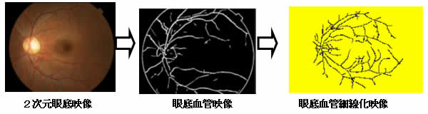 （図２）２次元眼底映像からの血管抽出