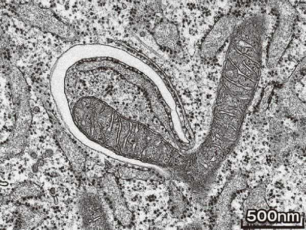 image:The moment an autophagosome is formed, as captured by an electron microscope.