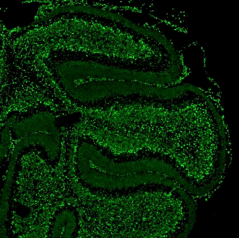 ノックインマウスの組織観察例の顕微鏡写真：小脳皮質
