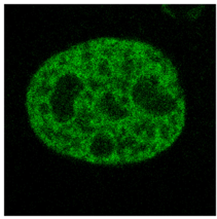 ノックインマウスの組織観察例の顕微鏡写真：皮膚繊維芽細胞