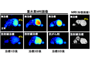 重水素ＭＲＩを用いたがん治療効果の早期予測法を開発～がん治療における治療効果の早期診断法として期待～