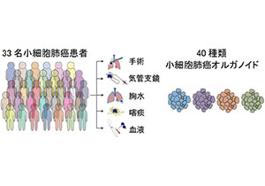 難治性癌の代表・小細胞肺癌の治療に新たな光～非神経内分泌タイプの小細胞肺癌にＩＧＦ１Ｒ阻害剤が有効な可能性～