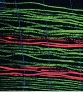 細胞の「ひも」が織りなす新しい医療 ―立体細胞組織構築の材料となる細胞ファイバーを開発―