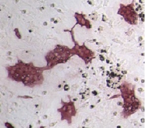 関節リウマチの発症の鍵となるＴ細胞を発見 ～免疫反応を抑制するＴ細胞が関節の炎症と骨破壊を促進するＴ細胞へ変身～