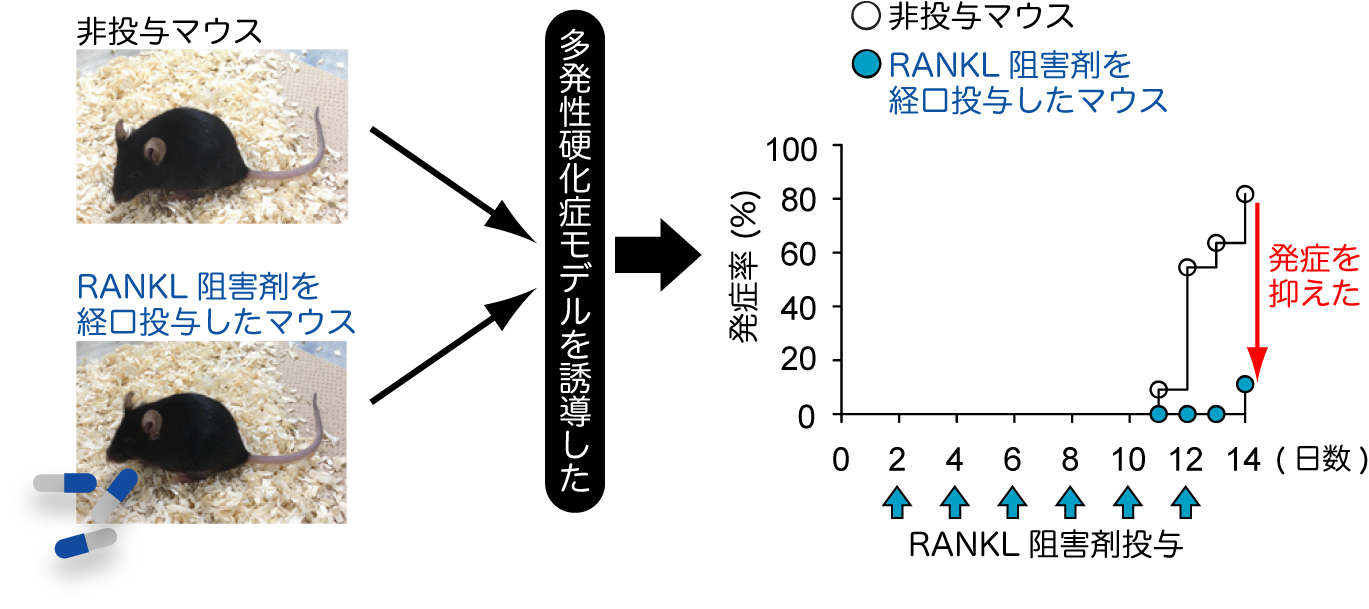 神経難病が起こる仕組みを解明 ～多発性硬化症の新しい治療法に道～