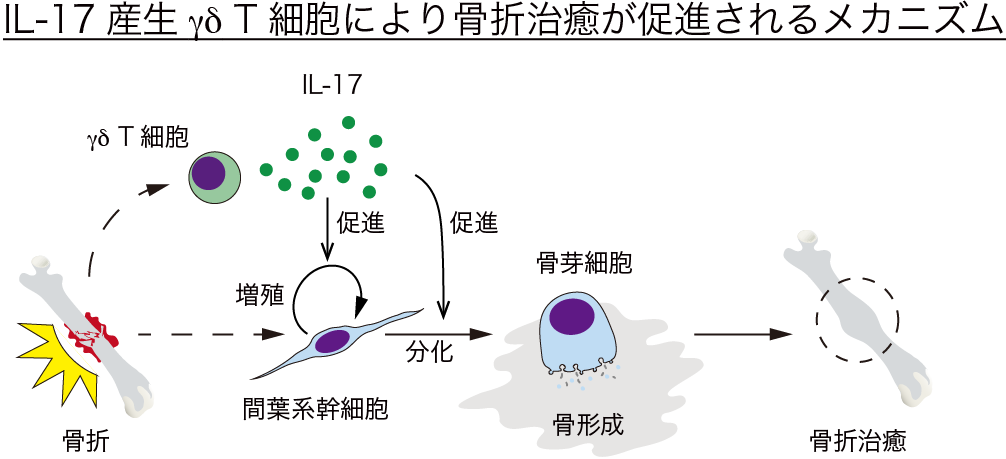 免疫系が骨を治す～骨折治癒の仕組みを解明～