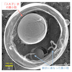 微生物が多様な膜小胞を作る仕組みを解明