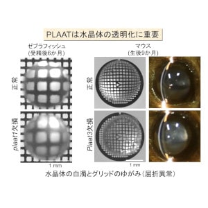 眼の水晶体が透明になる仕組みの解明 ～新たな細胞内分解システムの発見～