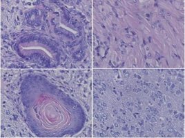 プラスミドで樹立したiPS細胞の多能性。腸管様上皮組織（左上）、表皮組織（左下）、横紋筋（右上）、神経組織（右下）などに分化することが示された。