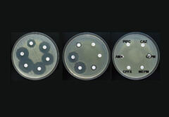 Antibiotic sensitivity experiment: once a bacterium develops multiple drug resistance, almost no antibiotics are effective against it. 