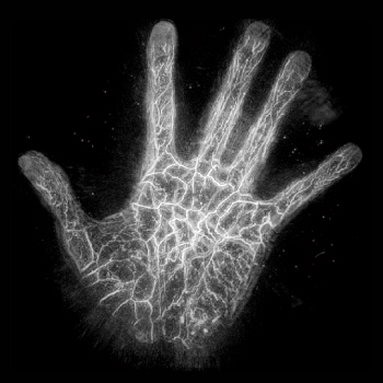 手のひらの3D血管の事例の写真