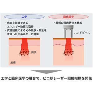 ピコ秒レーザーによるシミ・アザ治療の有効性向上へ！　臨床医学と工学の融合で治療時の照射指標を開発