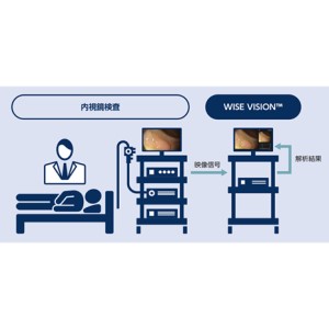 内視鏡AI診断支援医療機器ソフトウェア「WISE VISION 内視鏡画像解析AI」医療機器承認