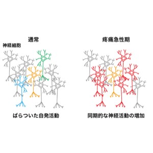 痛みを感じた時の脳内の神経回路変化をホログラフィック顕微鏡によって解明