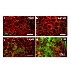 肝細胞内の薬物代謝活性を光で可視化することに成功 ～分子レベルの薬物応答をイメージングする～