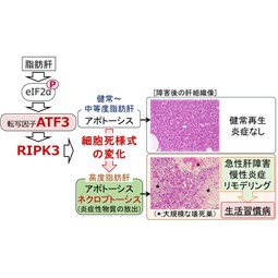 脂肪肝の重症化が、なぜ肝障害を起こすのか？そのメカニズムを解明！