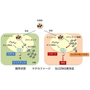 家族性組織球症SLC29A3異常症の病態を解明～原因不明の組織球性疾患の新たな治療標的TLR7／TLR8を発見～