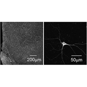 神経伝達物質を「見える化」するツールを開発 ～分子量の小さい生理活性物質の可視化に新たな光～