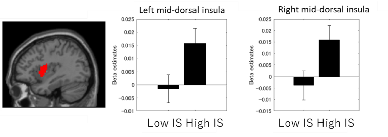 Figure 2. The mid insula activity modulated by the interoceptive sensitivity