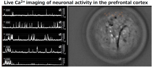 Live Ca2+ imaging of neuronal activity in the prefrontal cortex