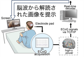 図4 侵襲BMI-CAによる発声 (Metzger et al., Nature, 2023)