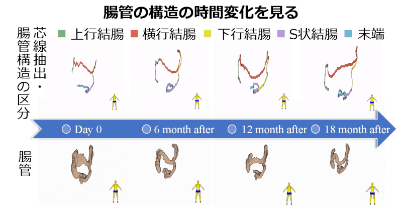図2 腸管の時間変化モデル