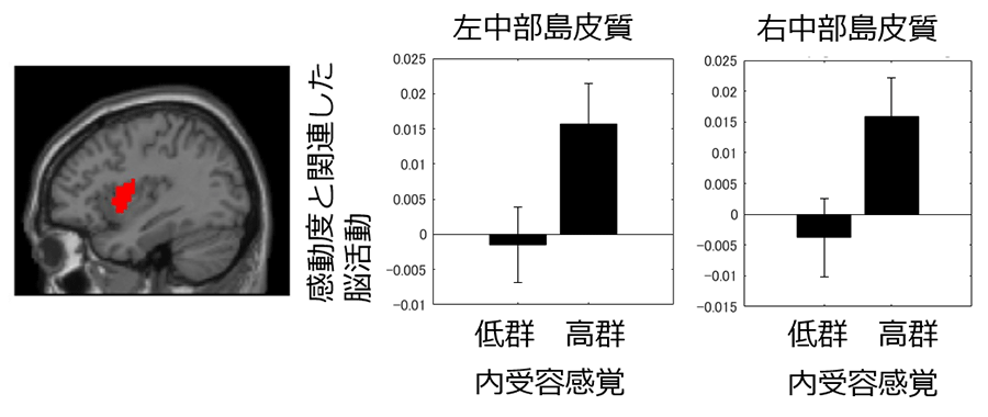 図2. 内受容感覚感度によって変化する中部島皮質の活動