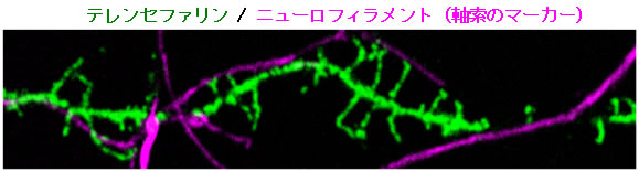 図３　初代培養海馬神経細胞におけるテレンセファリンの局在（二重免疫染色）