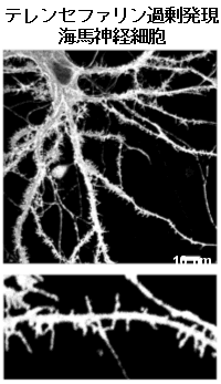 図４　テレンセファリン過剰発現による樹状突起フィロポディア形成
