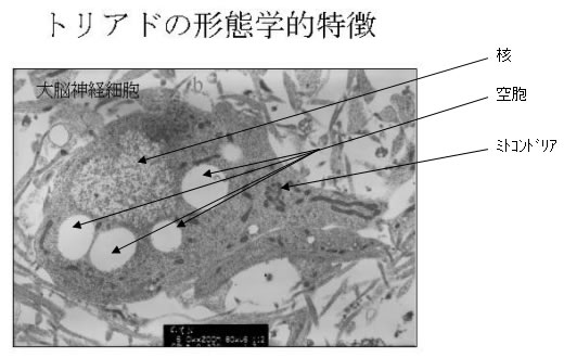 図１：トリアドの形態学的特徴