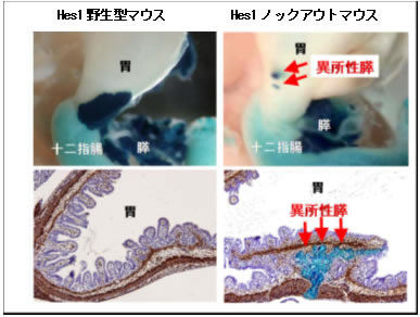 図３：Hes1ノックアウトマウスで胃に形成された異所性膵（LacZ陽性領域＝矢印）