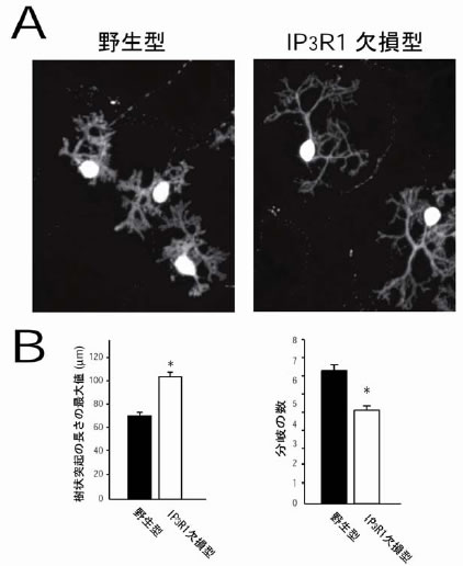 図２ IPB３B受容体タイプ１（IPB３BR1）を欠損したプルキンエ細胞の樹状突起伸展異常