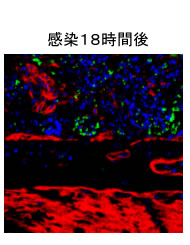 感染１８時間後